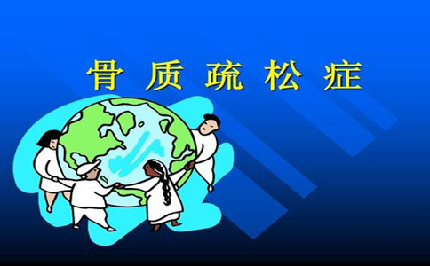 骨密度測(cè)量?jī)x